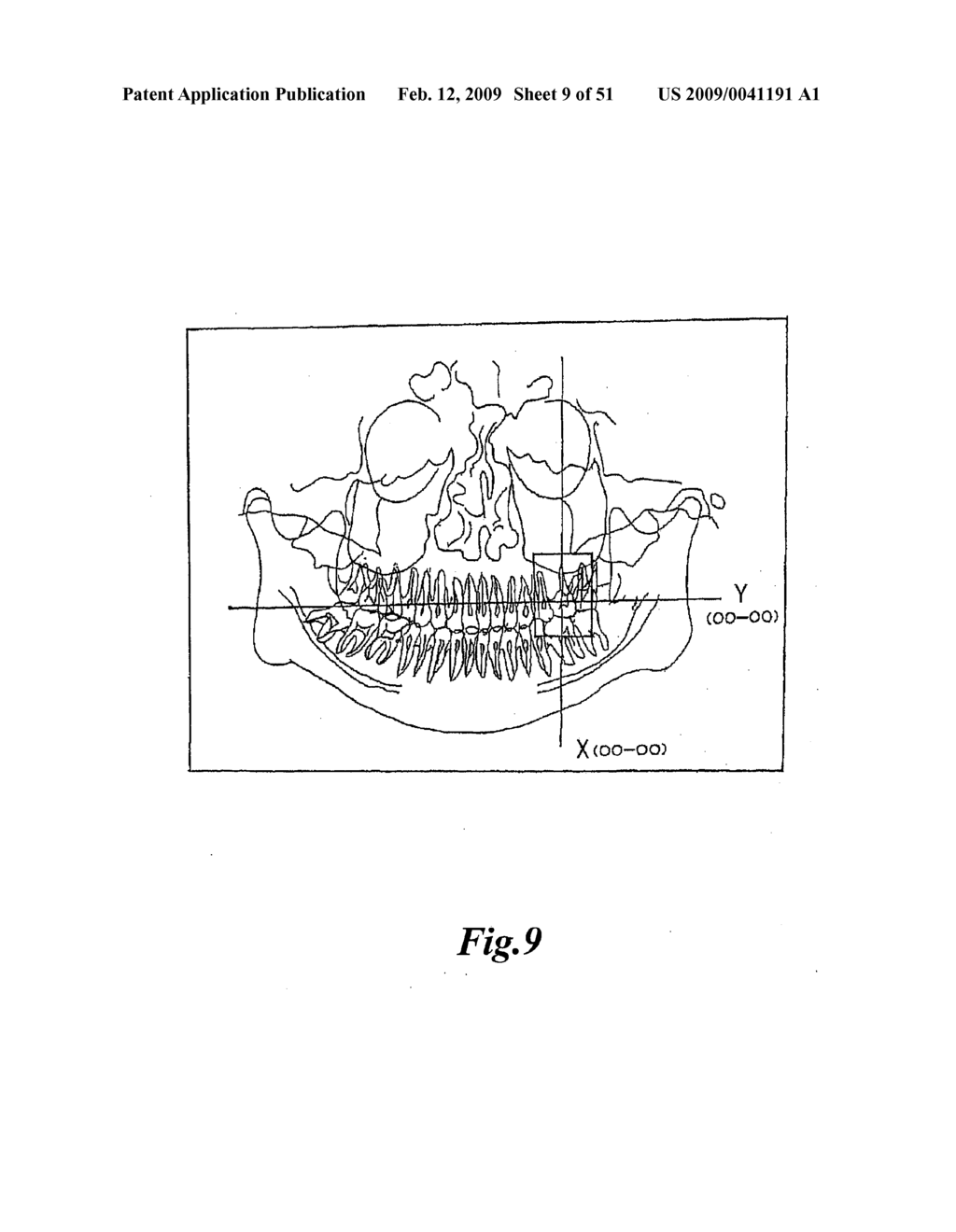 Radiography Apparatus With Scout View Function - diagram, schematic, and image 10