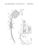 Endodontic Procedure Employing Simultaneous Liquefaction and Acoustic Debridgement diagram and image