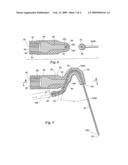 Endodontic Procedure Employing Simultaneous Liquefaction and Acoustic Debridgement diagram and image