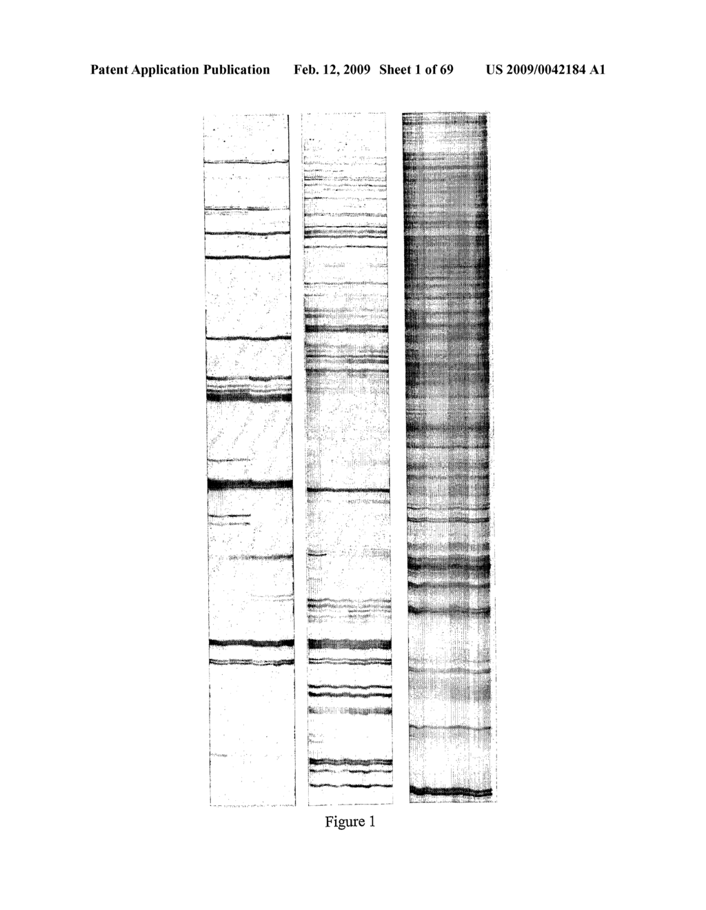 Method Of Diagnosing Cancer And Reagents Therefor - diagram, schematic, and image 02