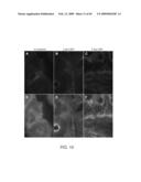 PDX1 EXPRESSING ENDODERM diagram and image