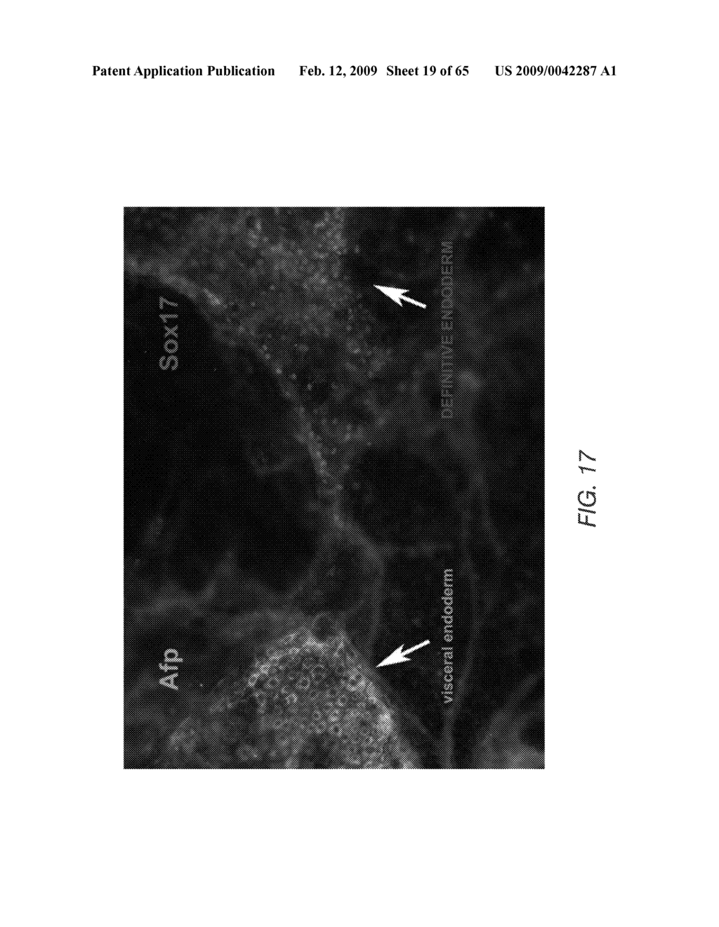 PDX1 EXPRESSING ENDODERM - diagram, schematic, and image 20