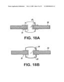 LAND GRID ARRAY FABRICATION USING ELASTOMER CORE AND CONDUCTING METAL SHELL OR MESH diagram and image