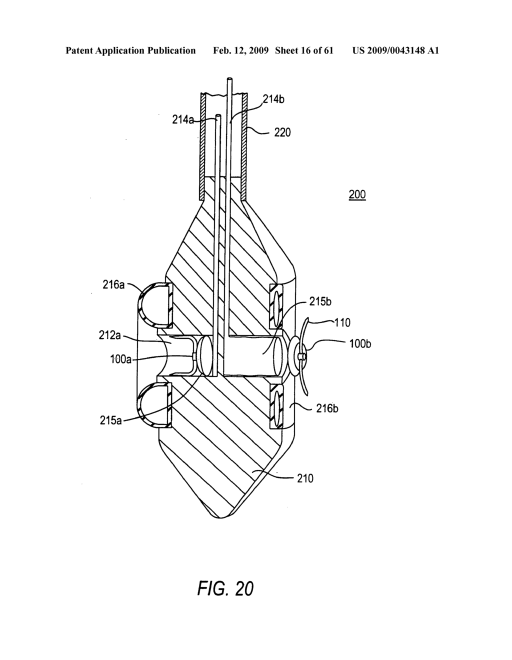 Use of magnetic implants to treat body tissue structrues - diagram, schematic, and image 17