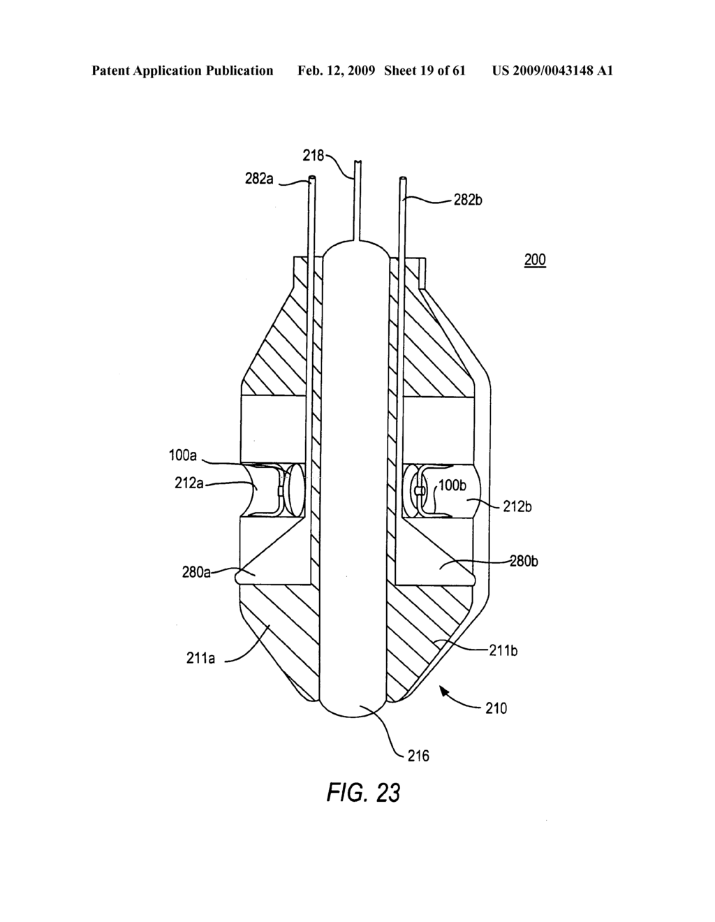 Use of magnetic implants to treat body tissue structrues - diagram, schematic, and image 20