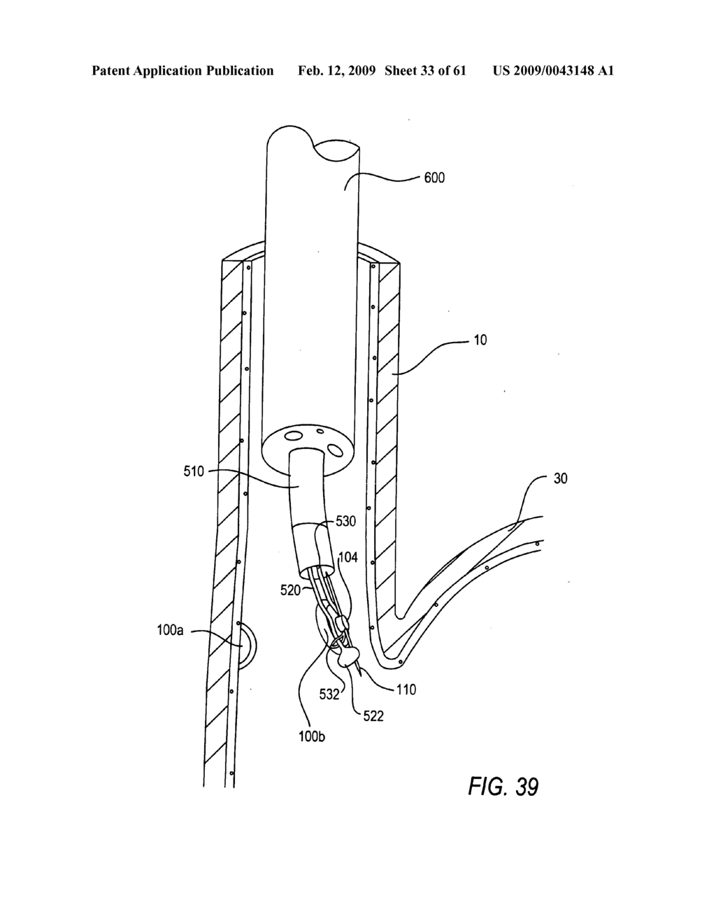 Use of magnetic implants to treat body tissue structrues - diagram, schematic, and image 34