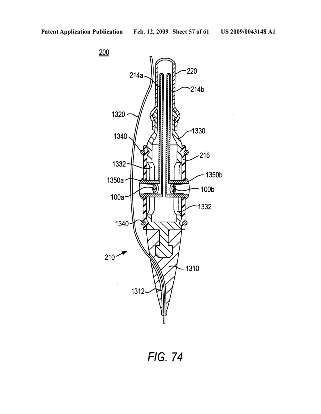 Use of magnetic implants to treat body tissue structrues - diagram, schematic, and image 58