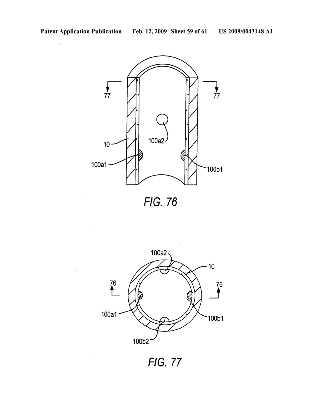 Use of magnetic implants to treat body tissue structrues - diagram, schematic, and image 60