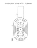 Mobile combined MRI/PET apparatus diagram and image