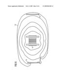 Mobile combined MRI/PET apparatus diagram and image