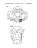 Mobile combined MRI/PET apparatus diagram and image