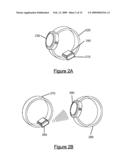 HEART BEAT SIGNAL RECOGNITION diagram and image