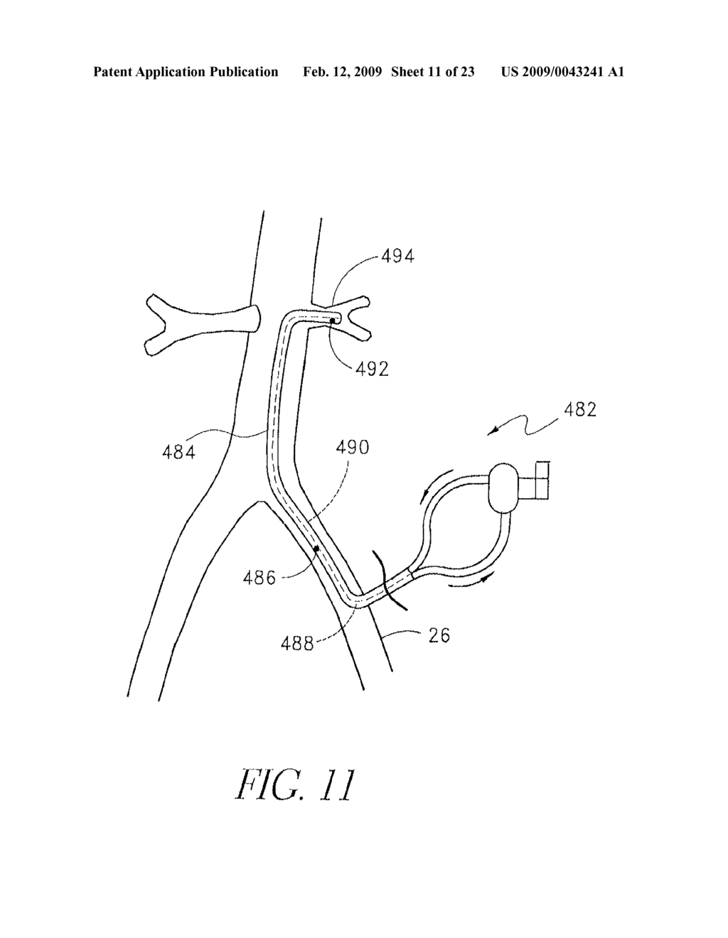 QUICK PRIMING CONNECTORS FOR BLOOD CIRCUIT - diagram, schematic, and image 12