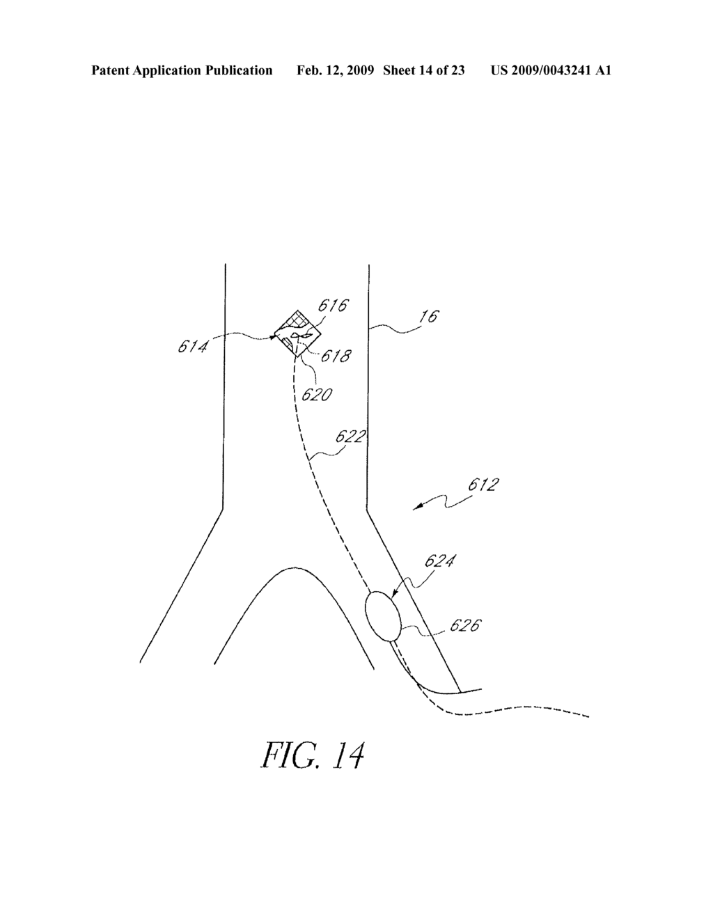 QUICK PRIMING CONNECTORS FOR BLOOD CIRCUIT - diagram, schematic, and image 15