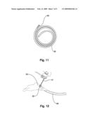 Magnetic Surgical Device to Manipulate Tissue in Laparoscopic Surgeries Performed with a Single Trocar or Via Natural Orifices diagram and image