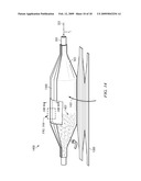 NON-COMPLIANT MEDICAL BALLOON diagram and image