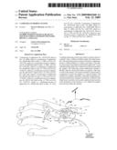 CATHETER ANCHORING SYSTEM diagram and image