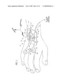 CATHETER ANCHORING SYSTEM diagram and image