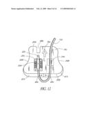 CATHETER ANCHORING SYSTEM diagram and image