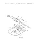 CATHETER ANCHORING SYSTEM diagram and image