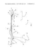 METHOD AND APPARATUS FOR DELIVERY OF A LIGATING SUTURE diagram and image