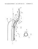 METHOD AND APPARATUS FOR DELIVERY OF A LIGATING SUTURE diagram and image