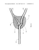 METHOD AND APPARATUS FOR DELIVERY OF A LIGATING SUTURE diagram and image