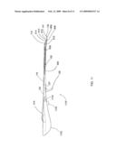 METHOD AND APPARATUS FOR DELIVERY OF A LIGATING SUTURE diagram and image