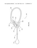 METHOD AND APPARATUS FOR DELIVERY OF A LIGATING SUTURE diagram and image