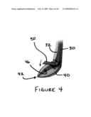 SURGICAL APPRATUS FOR CUTTING TISSUE diagram and image