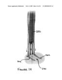 SURGICAL APPRATUS FOR CUTTING TISSUE diagram and image