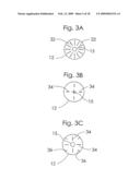 Circular stapler buttress diagram and image