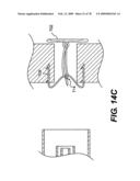 Method and Apparatus for Enhanced Delivery of Treatment Device to the Intervertebral Disc Annulus diagram and image