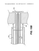 Method and Apparatus for Enhanced Delivery of Treatment Device to the Intervertebral Disc Annulus diagram and image