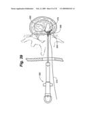 Method and Apparatus for Enhanced Delivery of Treatment Device to the Intervertebral Disc Annulus diagram and image