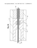 Method and Apparatus for Enhanced Delivery of Treatment Device to the Intervertebral Disc Annulus diagram and image