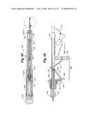 Method and Apparatus for Enhanced Delivery of Treatment Device to the Intervertebral Disc Annulus diagram and image