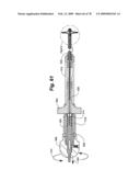 Method and Apparatus for Enhanced Delivery of Treatment Device to the Intervertebral Disc Annulus diagram and image