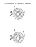 Method and Apparatus for Enhanced Delivery of Treatment Device to the Intervertebral Disc Annulus diagram and image