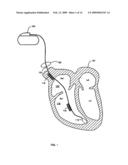 Method and system for characterizing supraventricular rhythm during cardiac pacing diagram and image