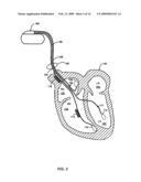 Method and system for characterizing supraventricular rhythm during cardiac pacing diagram and image