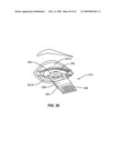 METHODS, APPARATUSES, AND SYSTEMS FOR REDUCING INTRAOCULAR PRESSURE AS A MEANS OF PREVENTING OR TREATING OPEN-ANGLE GLAUCOMA diagram and image