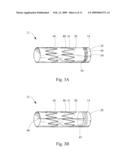 ENDOLUMINAL DEVICE INCLUDING A MECHANISM FOR PROXIMAL OR DISTAL FIXATION, AND SEALING AND METHODS OF USE THEREOF diagram and image