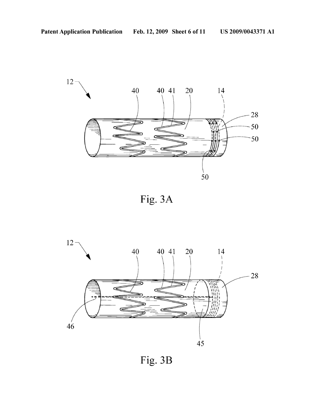 ENDOLUMINAL DEVICE INCLUDING A MECHANISM FOR PROXIMAL OR DISTAL FIXATION, AND SEALING AND METHODS OF USE THEREOF - diagram, schematic, and image 07