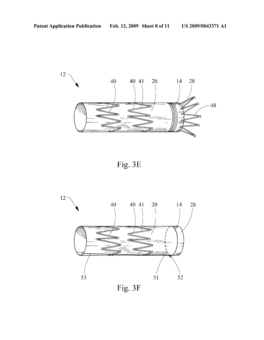 ENDOLUMINAL DEVICE INCLUDING A MECHANISM FOR PROXIMAL OR DISTAL FIXATION, AND SEALING AND METHODS OF USE THEREOF - diagram, schematic, and image 09