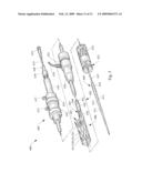 ENDOLUMINAL DEVICE INCLUDING A MECHANISM FOR PROXIMAL OR DISTAL FIXATION, AND SEALING AND METHODS OF USE THEREOF diagram and image