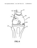 DEVICES AND METHODS FOR TREATING DEFECTS INTHE TISSUE OF A LIVING BEING diagram and image