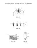 DEVICES AND METHODS FOR TREATING DEFECTS INTHE TISSUE OF A LIVING BEING diagram and image