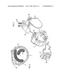 Knee joint prosthesis diagram and image