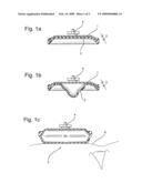 Forehead Pad for a Breathing Mask and Method for Making the Same diagram and image